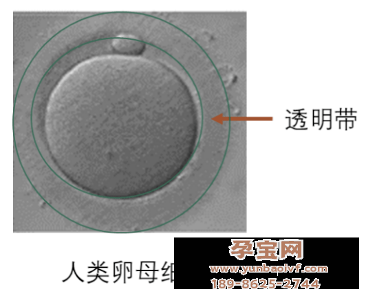  试管婴儿