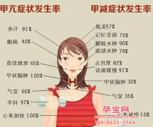  试管婴儿