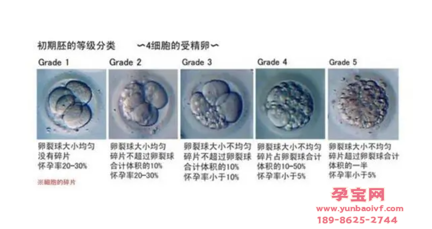  试管婴儿