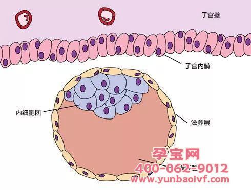 试管婴儿