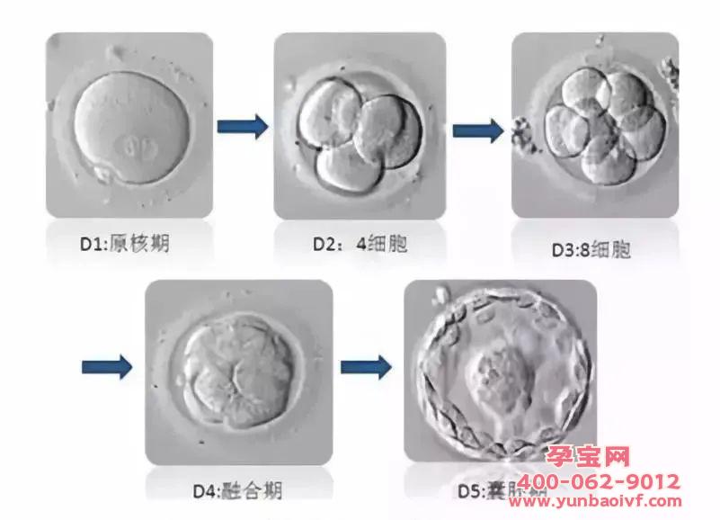 试管婴儿